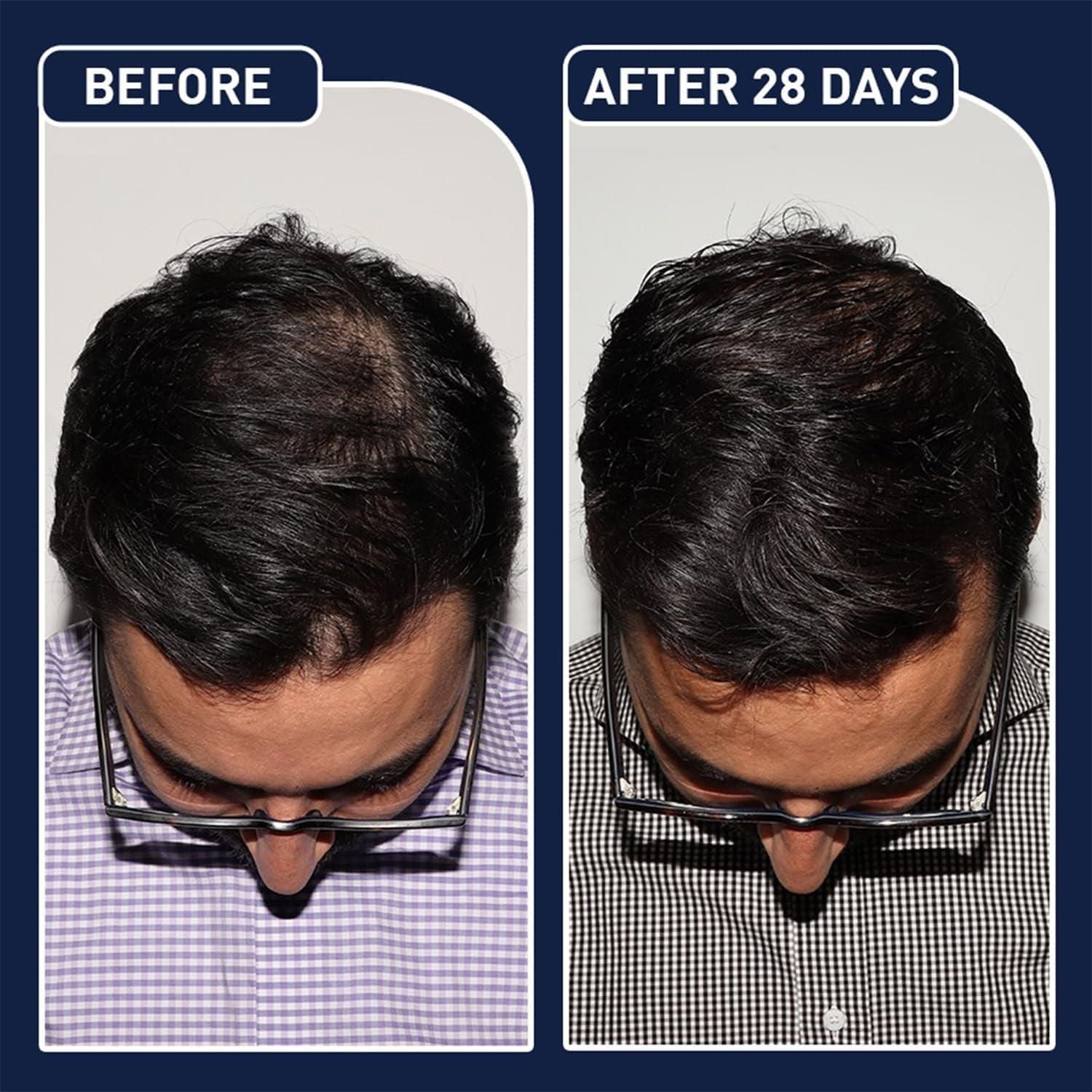 FEG+ Hair Growth Spray – 50ml (Pack of 2)